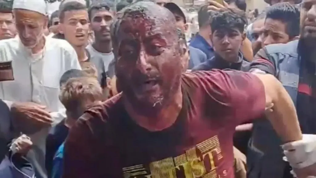 Recently, a video surfaced on social media showing an injured man in Gaza criticizing the actions of the Hamas leadership.